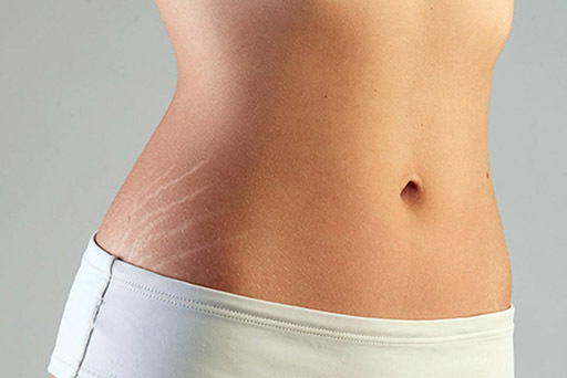 ترک های پوستی